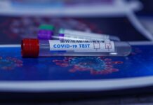 Nemocnice pozastavuje koronavirové testování samoplátců