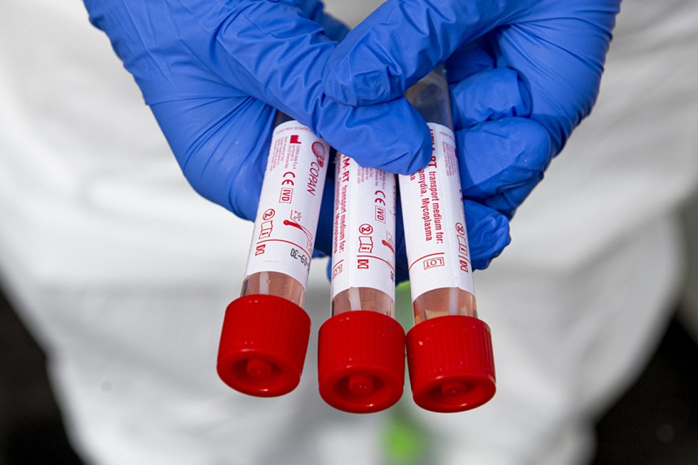 Roudnická nemocnice začíná testovat na koronavirus