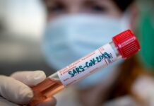 Litoměřická nemocnice pozastavila koronavirové testování samoplátců, denně otestuje až 100 lidí