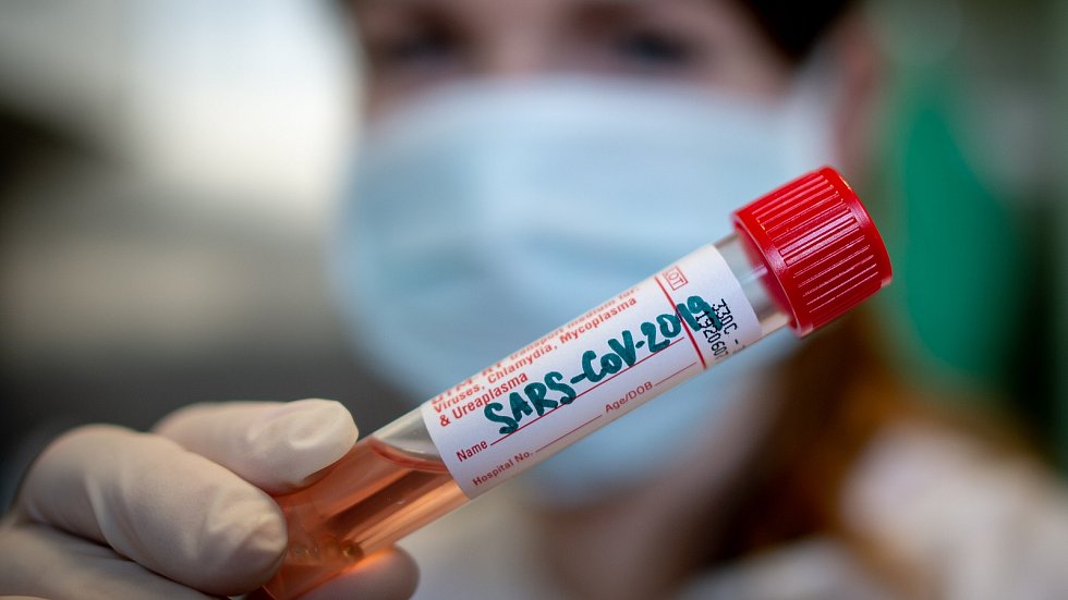 Litoměřická nemocnice pozastavila koronavirové testování samoplátců, denně otestuje až 100 lidí