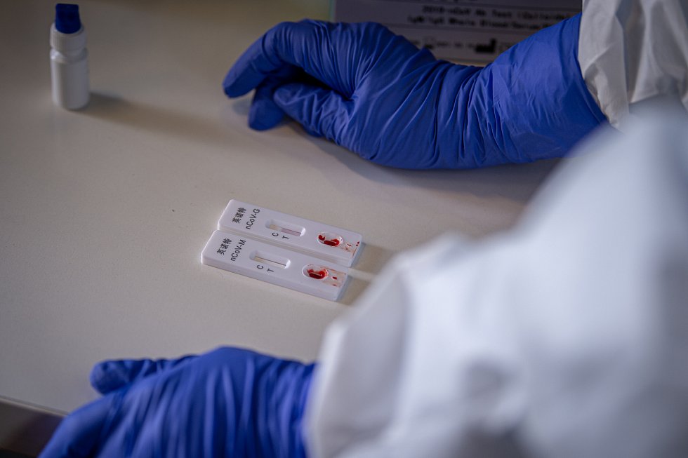 Začíná antigenní testování veřejnosti. Necháte se otestovat?