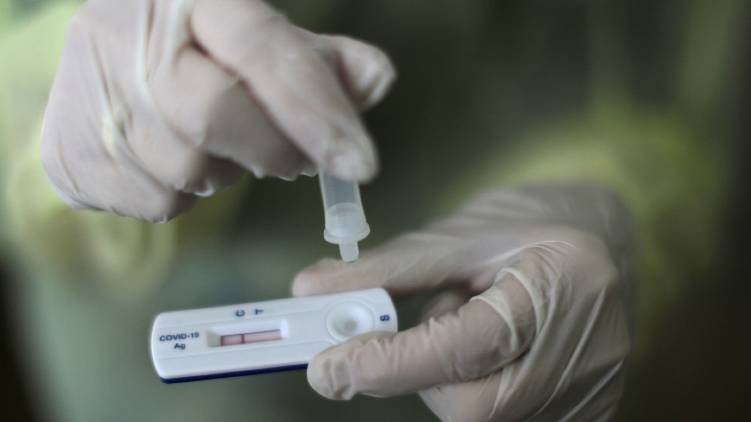 Testy na COVID-19 nově na Zahradě Čech