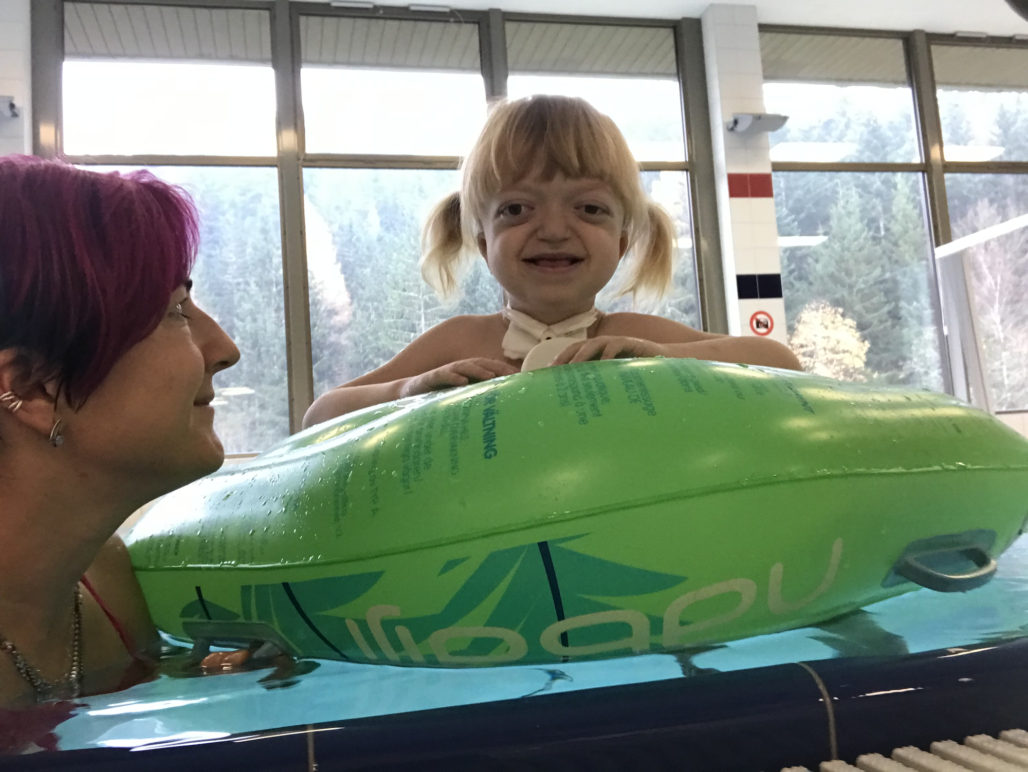 Mondi Štětí shání peníze pro těžce nemocnou Lilli